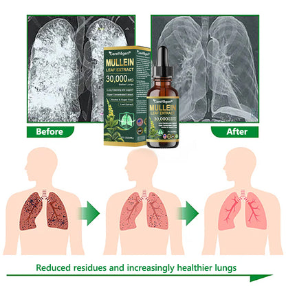 𝗢𝗳𝗳𝗶𝗰𝗶𝗮𝗹 𝗦𝘁𝗼𝗿𝗲:CareRegen®𝗢𝗿𝗴𝗮𝗻𝗶𝗰 𝗟𝘂𝗻𝗴 𝗖𝗹𝗲𝗮𝗻𝘀𝗶𝗻𝗴 𝗠𝘂𝗹𝗹𝗲𝗶𝗻 𝗟𝗲𝗮𝗳 𝗘𝘅𝘁𝗿𝗮𝗰𝘁 𝗗𝗿𝗼𝗽𝘀 🎁𝐂𝐥𝐢𝐧𝐢𝐜𝐚𝐥𝐥𝐲 𝐩𝐫𝐨𝐯𝐞𝐧, 𝐡𝐢𝐠𝐡𝐥𝐲 𝐜𝐨𝐧𝐜𝐞𝐧𝐭𝐫𝐚𝐭𝐞𝐝 𝐟𝐨𝐫𝐦𝐮𝐥𝐚 𝐭𝐡𝐚𝐭 𝐫𝐞𝐥𝐢𝐞𝐯𝐞𝐬 𝐜𝐨𝐮𝐠𝐡, 𝐩𝐡𝐥𝐞𝐠𝐦, 𝐚𝐬𝐭𝐡𝐦𝐚 & 𝐂𝐎𝐏𝐃 — 𝐛𝐫𝐞𝐚𝐭𝐡𝐞 𝐞𝐚𝐬𝐢𝐞𝐫, 𝐟𝐚𝐬𝐭𝐞𝐫. 🎁