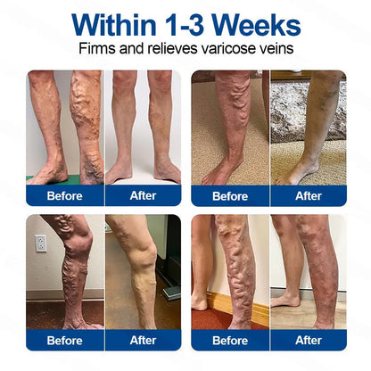 🇺🇸👨‍⚕️👍✅Healrize® VeinTarget Microneedle Patch⚡Instant Relief, Long-Term Results🌞