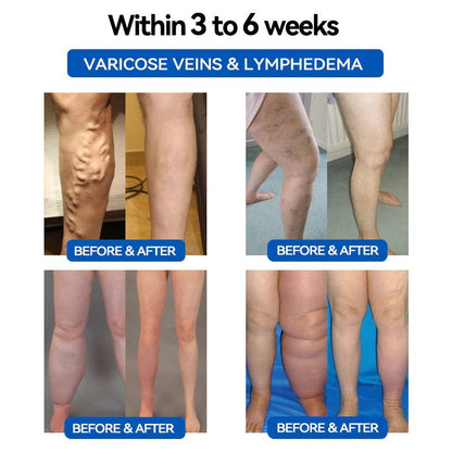 JoMe𝖽𝗂𝗑®👩‍⚕️🧬 Ultrasound Fat Breakdown and Far-Infrared Detoxifying Blood Sugar Balancing Bracelet