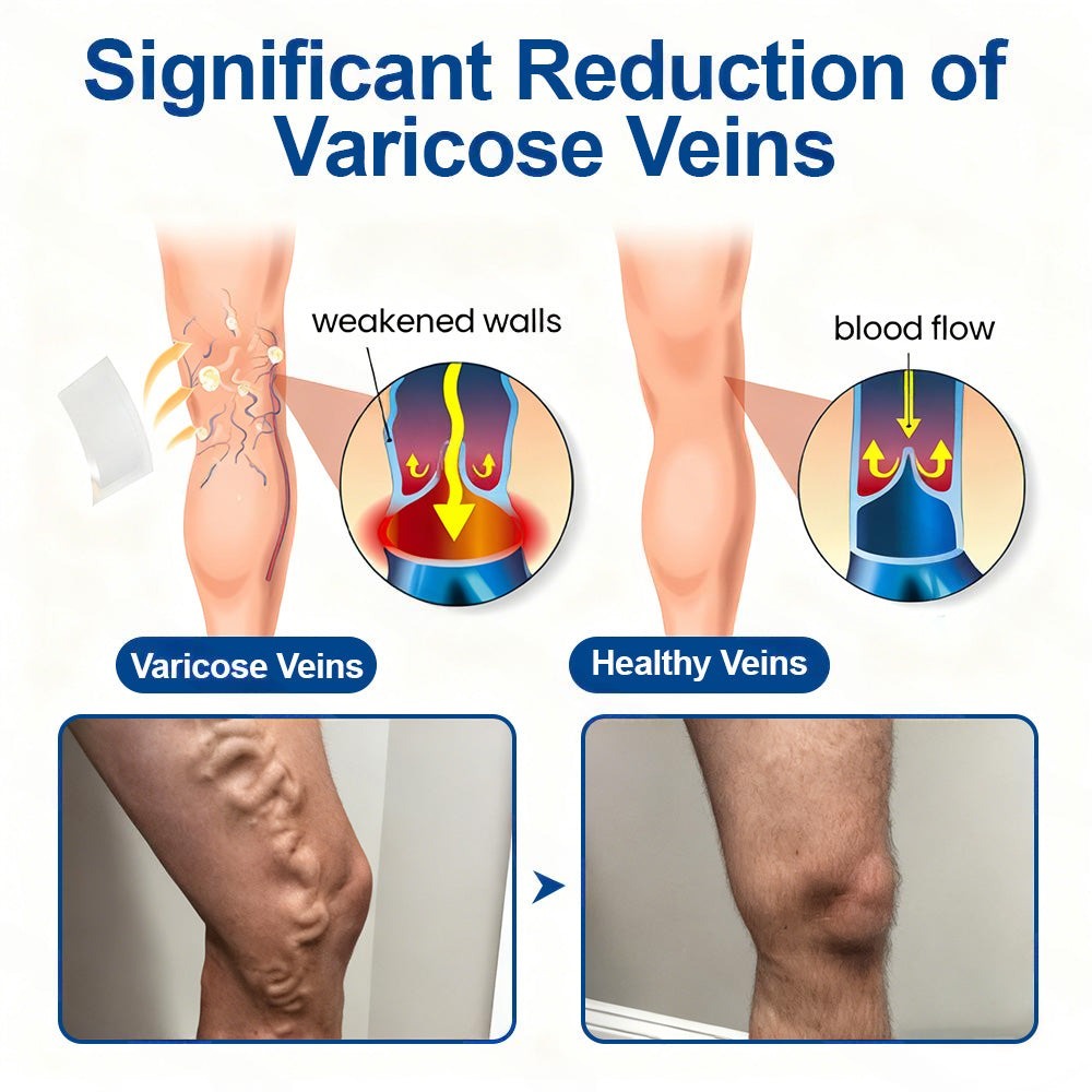 🇺🇸👨‍⚕️👍✅Healrize® VeinTarget Microneedle Patch⚡Instant Relief, Long-Term Results🌞
