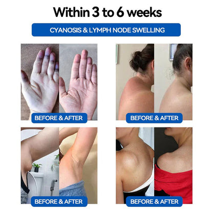JoMe𝖽𝗂𝗑®👩‍⚕️🧬 Ultrasound Fat Breakdown and Far-Infrared Detoxifying Blood Sugar Balancing Bracelet