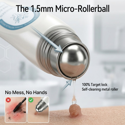 𝐇e𝐚𝐥𝐫i𝐳e® 7-𝐷𝑎𝑦 𝗧𝐚𝐠 & 𝗦𝗽𝐨𝐭 𝐄𝐫𝒂𝒔𝒆𝒓(Zero Pain, Zero 𝐒𝐜𝐚𝒓𝒔 Rollerball)🌞